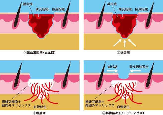 湿潤療法について（facebookより転載 2019-5-10）